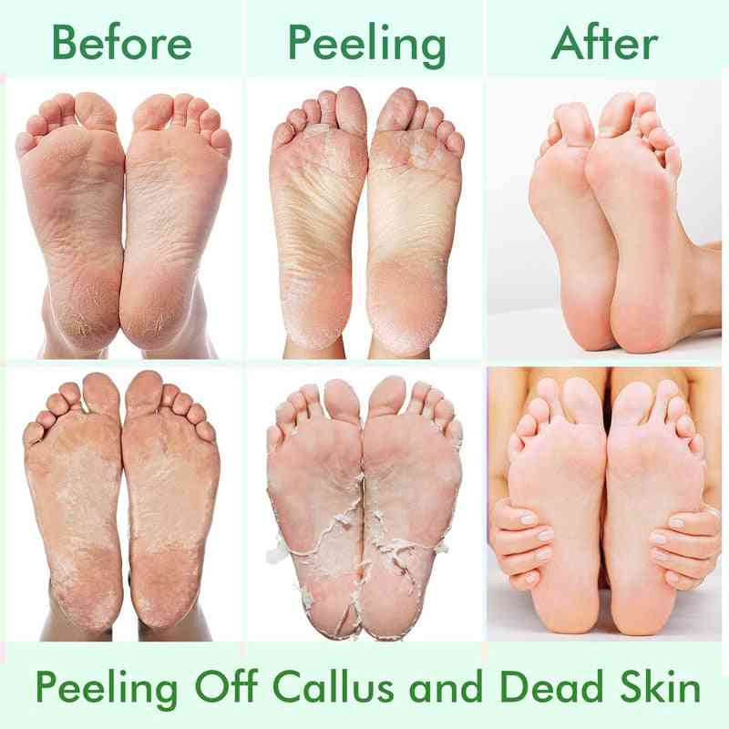 Eksfolierende fodmaske - blegemiddel til fjernelse af død hud, maske til afskalning af fod til pedicure