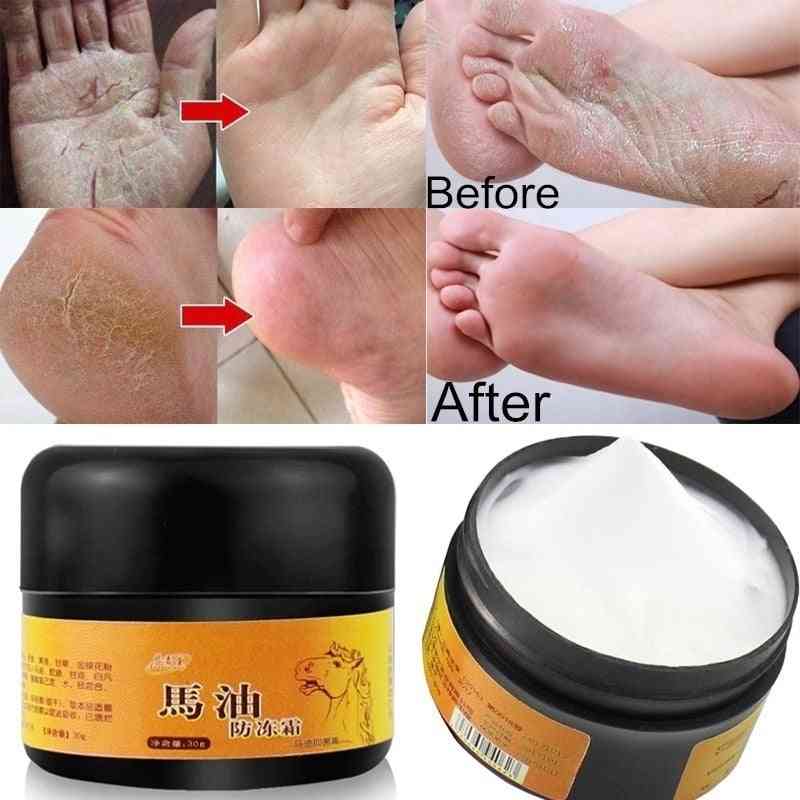Foot, Hand Antifreeze Horse Oil Dry Cream Repair Anti Chapping Wrinkle Treatment Ointment