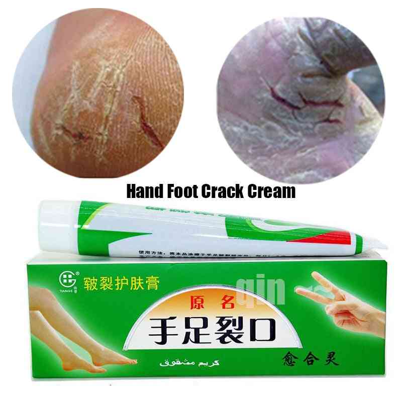 Crème pour les fissures des pieds à la main Peeling réparation talon gercé Pommade anti-fissure sèche Crème pour les pieds exfoliante
