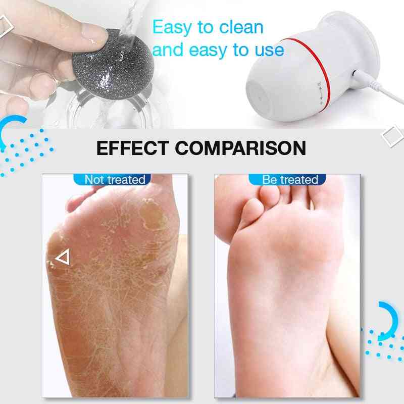Usb Rechargeable Adsorption Foot Grinder Electric Vacuum Adsorpt Foot Grinder Electric Foot File Vacuum