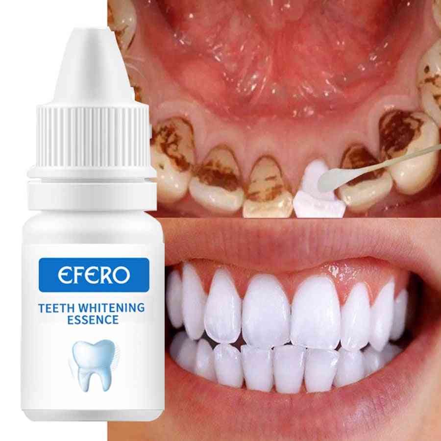 Teeth Whitening Serum Gel Dental - Oral Hygiene Effective, Remove Stains ,plaque Teeth Cleaning Essence