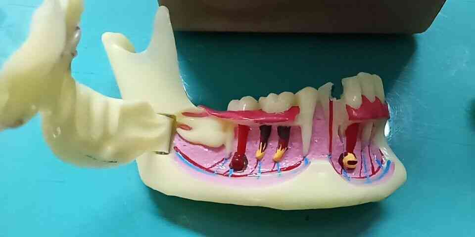 Zahnärztliches endodontisches Behandlungsmodell Anatomie des Zahnfleisches Zahnstudie lehren Zahnmodell