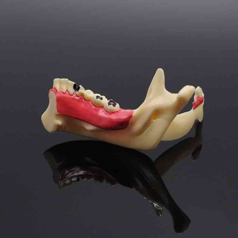 Anatomical Model Of Gingival Nerve-teeth Model For Dental Study
