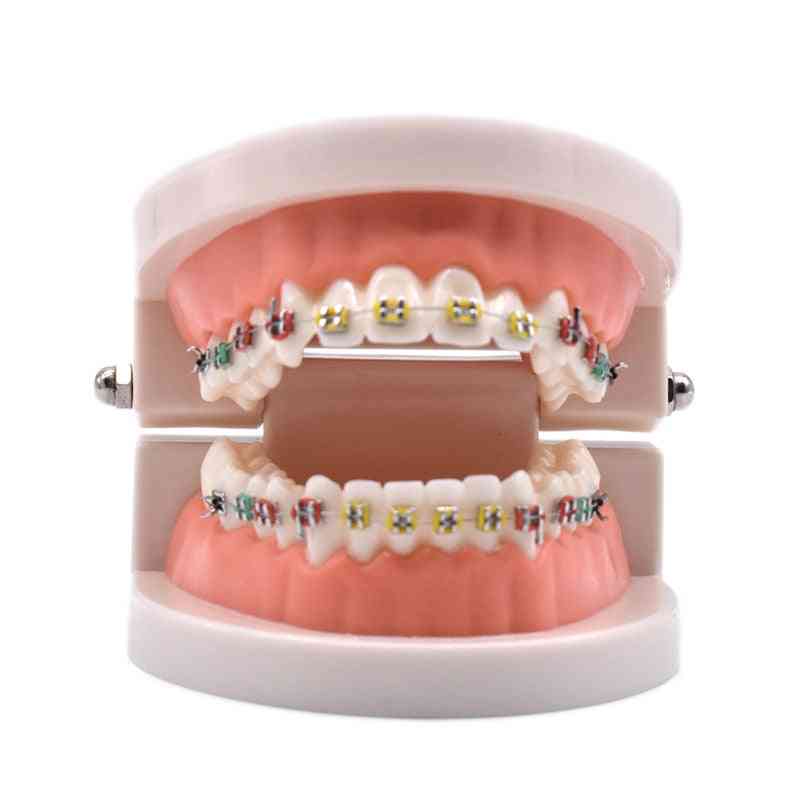 Dental Orthodontic Treatment Model With Ortho Metal Ceramic Bracket Arch Wire Buccal Tube Ligature Ties Dental Tools