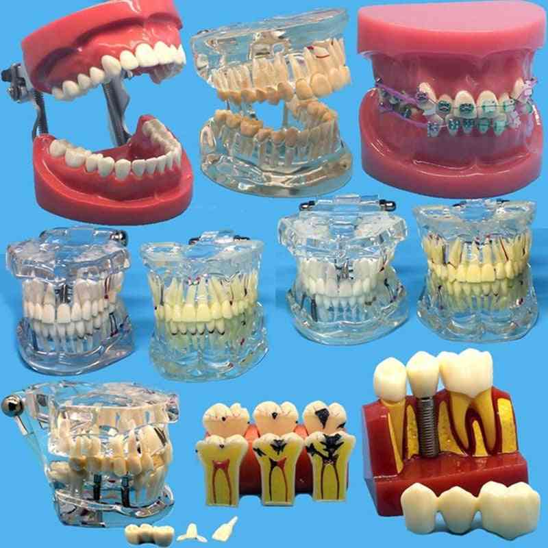 Various Dental Teeth Models For Teaching