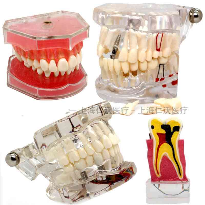Různé modely zubních zubů pro výuku