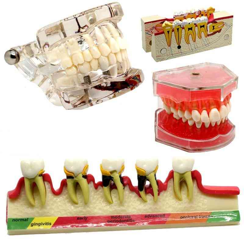Různé modely zubních zubů pro výuku