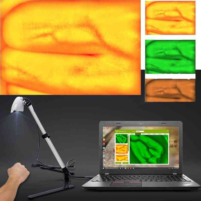 Visor de venas avanzado ajustable para niños adultos - pantalla luces infrarrojas imágenes de cámara usb -