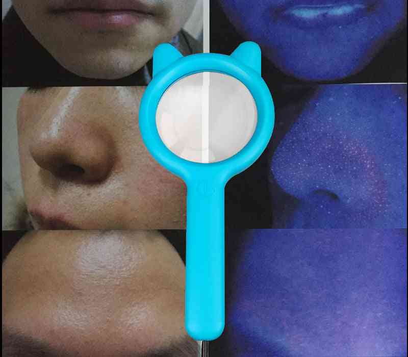 Prenosná drevná očná lampa pre vitiligo a prístroj na analýzu pokožky