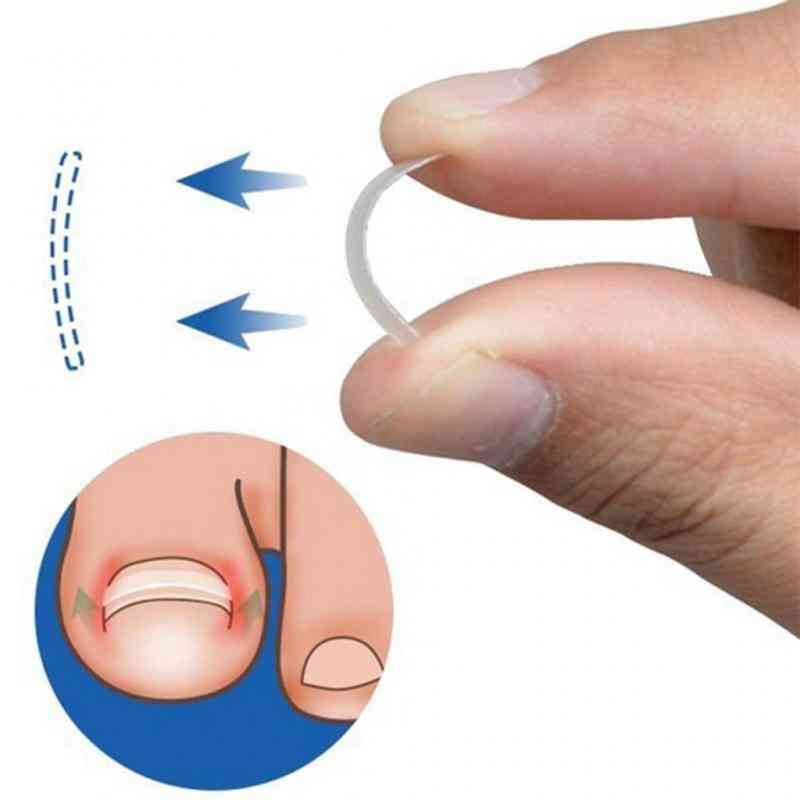 Pedicure per la cura dei piedi adesivo patch elastico per il trattamento delle unghie