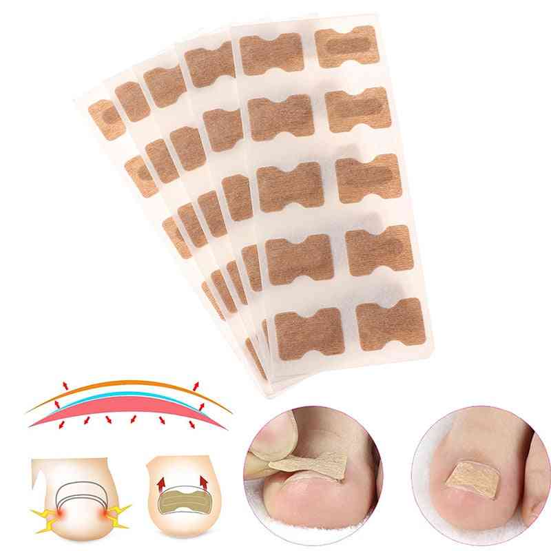 Nail Art Ingrown, Correction Sticker For Foot Care Pedicure Tool