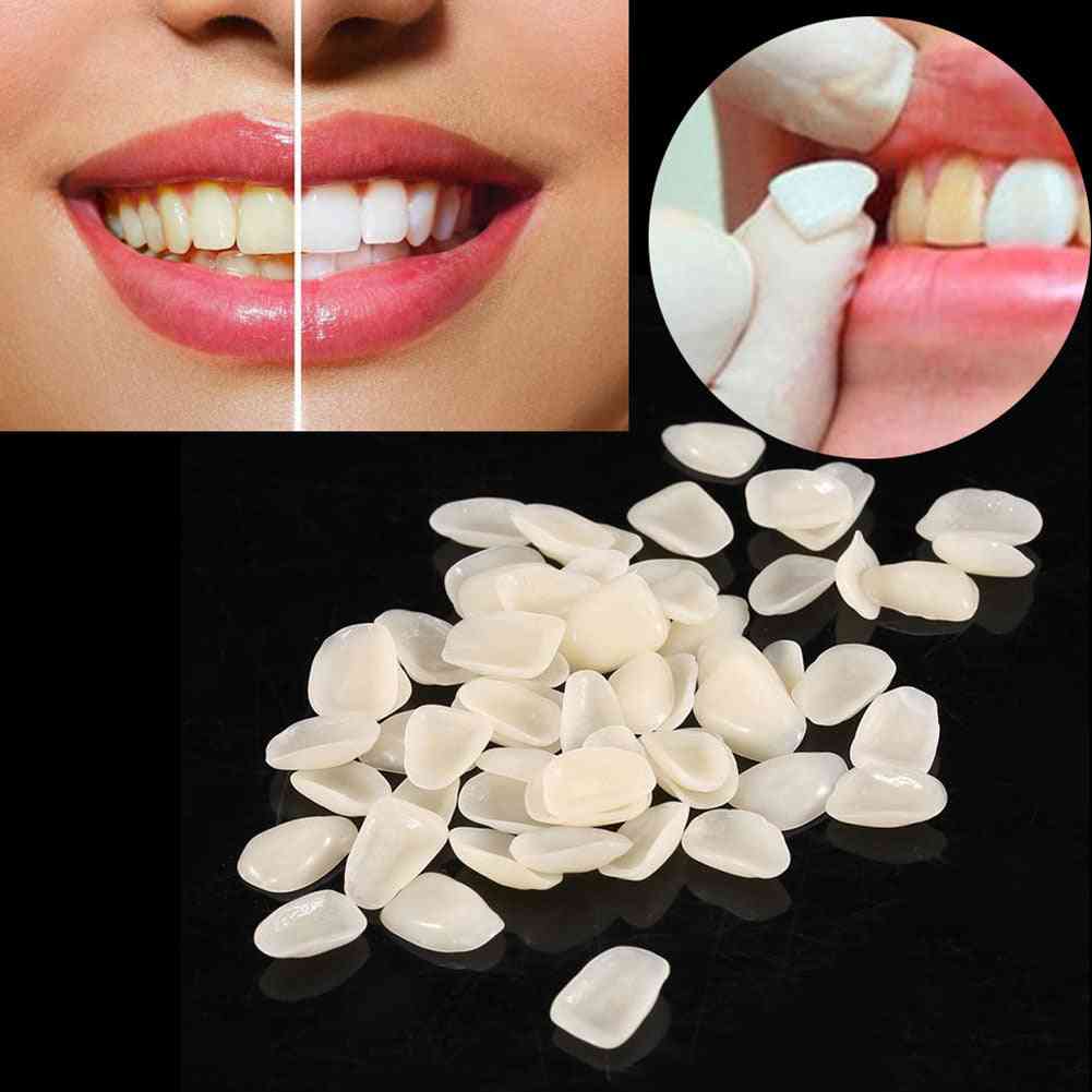 Dental Ultrathin Composite Resin Veneers Upper Anterior Tooth Whitening