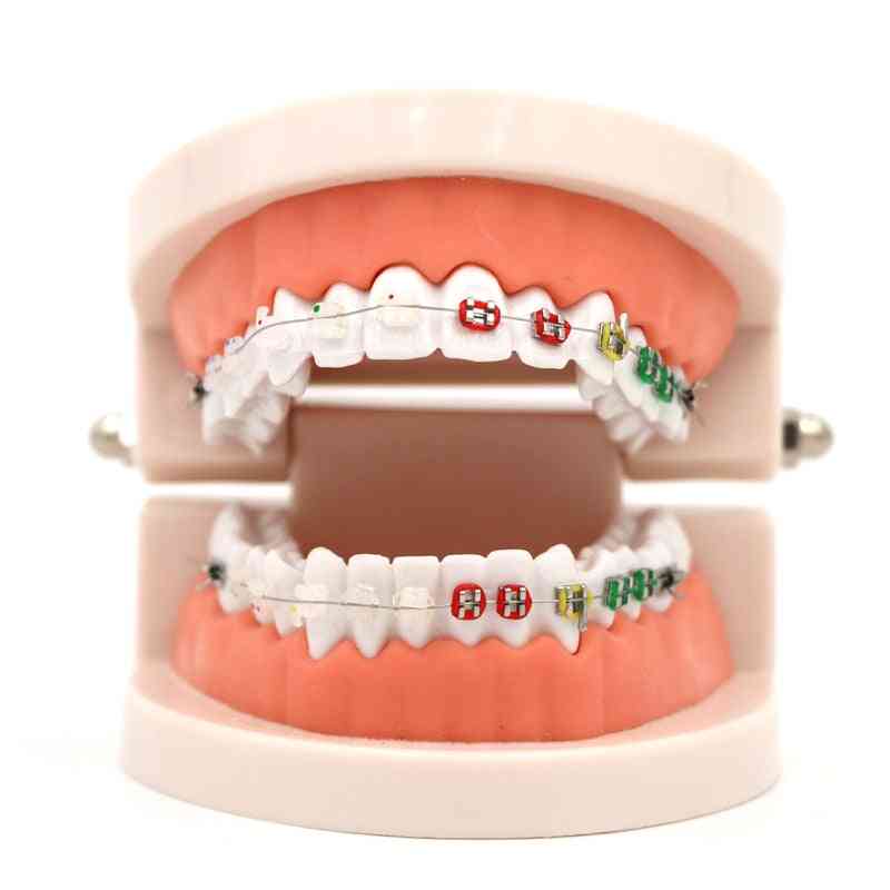 Modello di trattamento ortodontico dentale con staffa in ceramica ortometallica