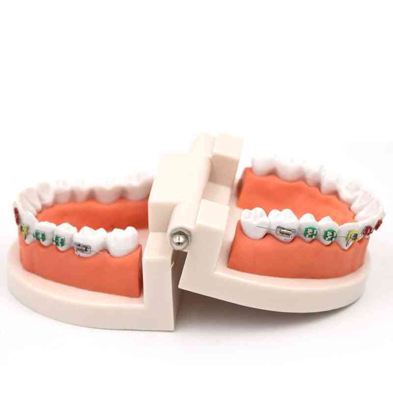 Modello di trattamento ortodontico dentale con staffa in ceramica ortometallica