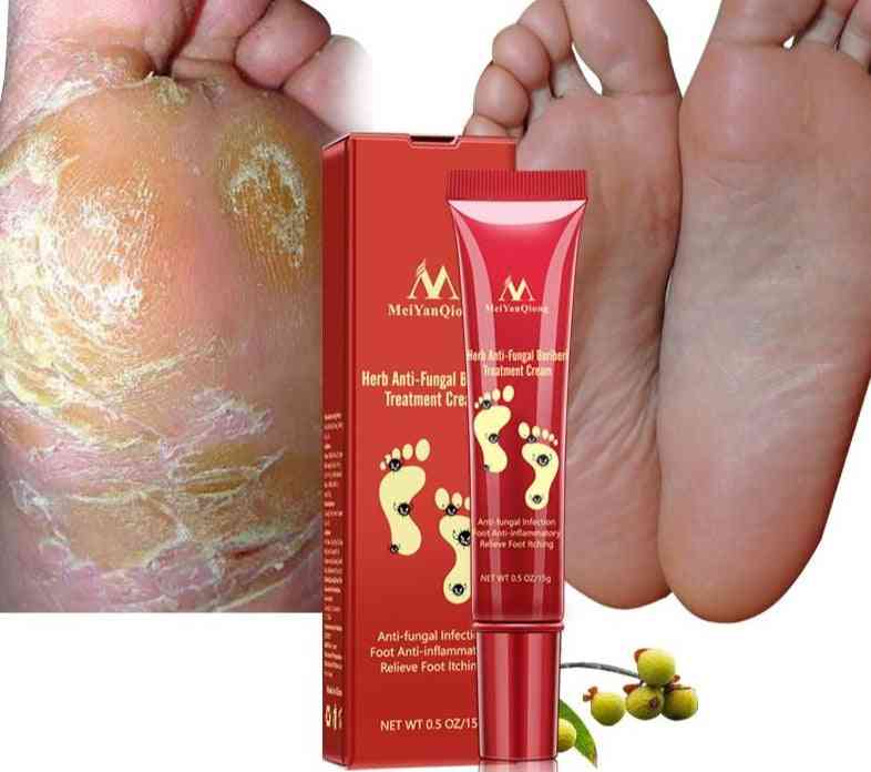Crema per la cura dei piedi beriberi allevia l'antimicotico a base di erbe
