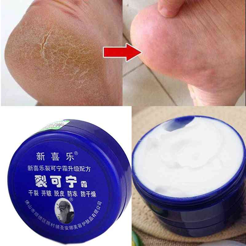 Anti-torkande spricka fotkräm borttagning död hud hand fötter vård