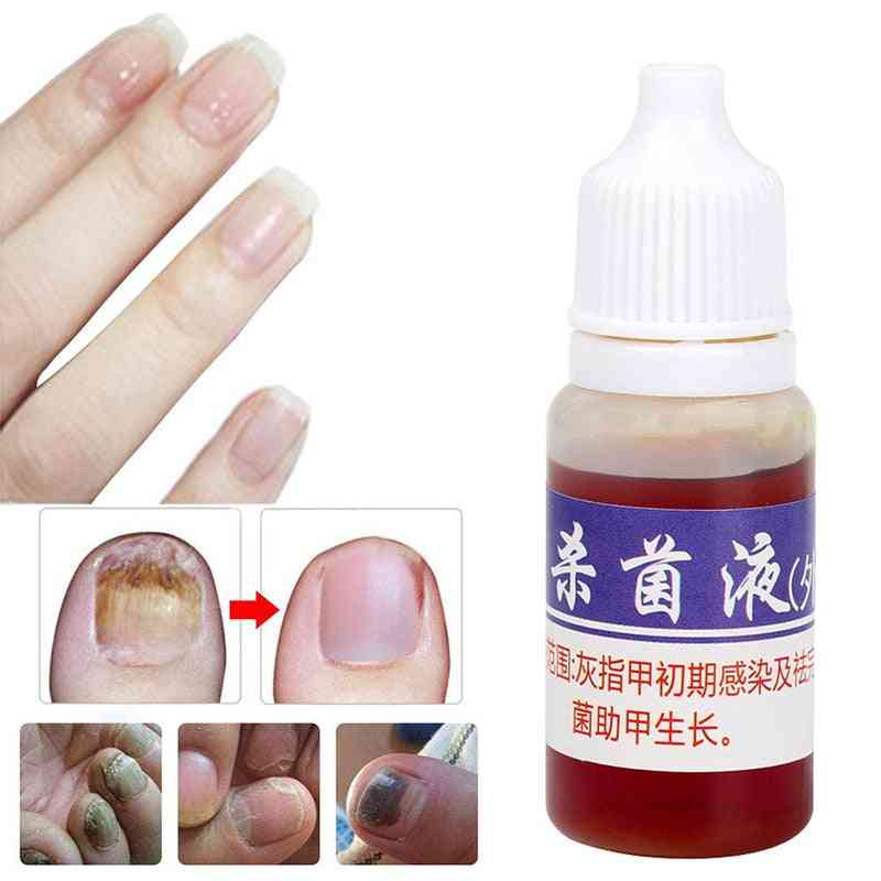 Flytande nagelband nagelreparation behandling olja närande ljusare hand fotvård