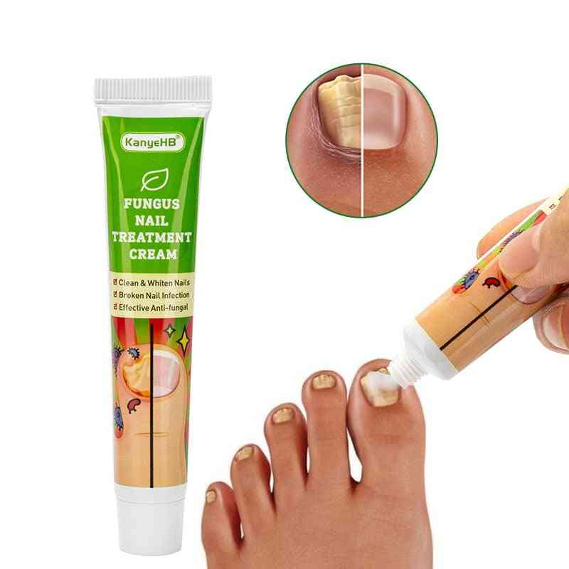 Treatment Cream Removal Nail Ointment