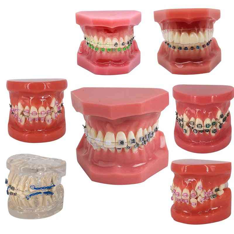 Dental Model With Braces Dentistry Teeth