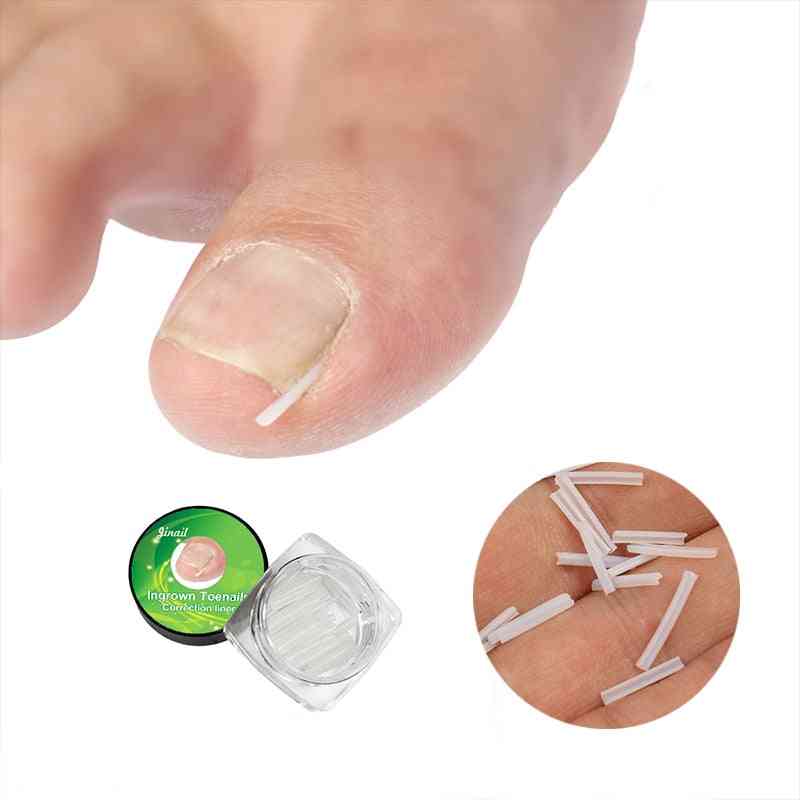 Relief Pain Silicone Ingrown Nail Pad