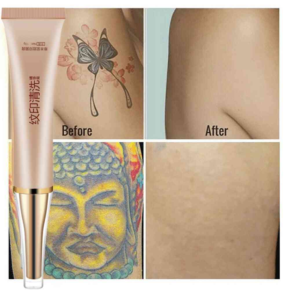 New Permanent Tattoo Removal Cream