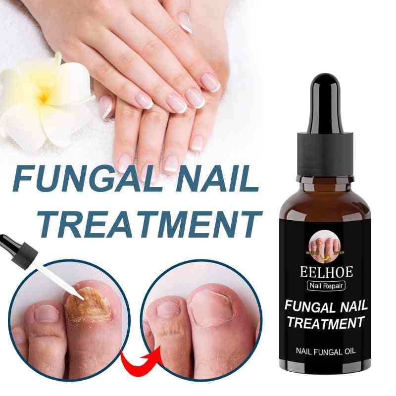 Fast Fungal Nail Treatments Serum Onychomycosis Paronychia Anti-fungal Nail Sensitive Herb Toe Fungus Foot Repair Essences Care