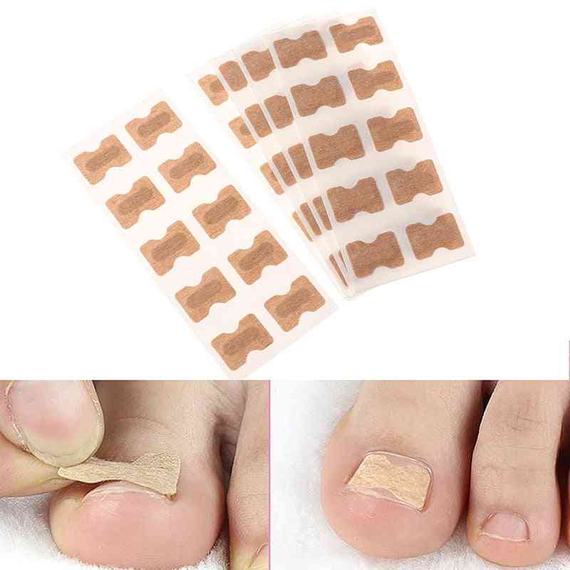 10pcs/50pcs Nail Art Ingrown Correction Sticker Foot Care Pedicure Tool Fixer Paronychia Recover Toenail Elastic Patch Corrector